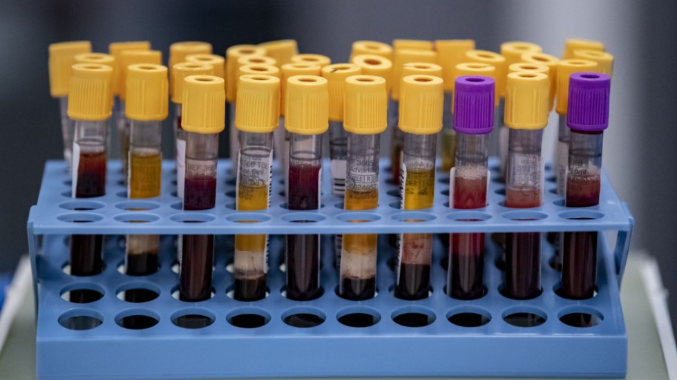 I biobankslagen regleras bland annat hur PKU-registret får användas. Där finns blodprov från miljontals personer som har fötts på ett svenskt sjukhus sedan mitten på 1970-talet.