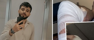Kamal, 35, attackerad – av kundens hund