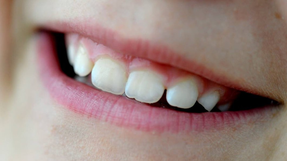 Folktandvården hoppas att en applikation ska göra det roligare för barn att sköta sina tänder.