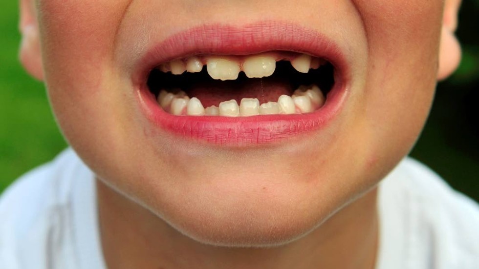 Ett barn som har ont i en tand ska inte behöva vänta orimligt länge på tandvård, menar insändarskribenten.