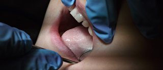 Tandvårdens resurser går till friska patienter i åldersgruppen 20–23 år