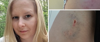 Marja, 29, attackerades av hund i Torshälla – blev biten i låret: "Ägaren klarade inte av att hålla hunden"