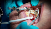 Anmälda tandläkaren får inte tillbaka sin legitimation