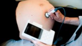 Skåne testar ny modell för förlossningsrädda