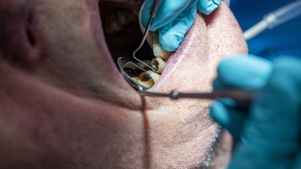 Skribenten varnar för sämre tandhälsa hos äldre när de inte vågar ta sig till tandläkaren av rädsla för coronasmitta.