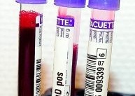 Metod som kan lösa blodbristen