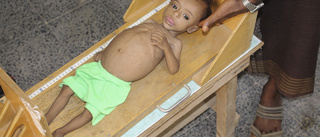 Allt fler barn undernärda i krigets Jemen