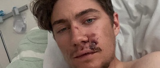 Ännu en smedförare till sjukhus efter våldsam krasch: "Det var blod överallt" ✓Krocken fångad på film som du kan se här