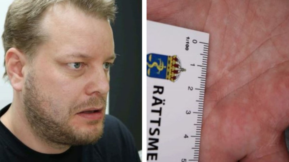 Daniel Nyqvist fotograferades i samband med att han efter gripandet genomgick en läkarundersökning. 