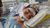 Alex, 15, låg nedsövd i nära sju dygn efter svåra olyckan