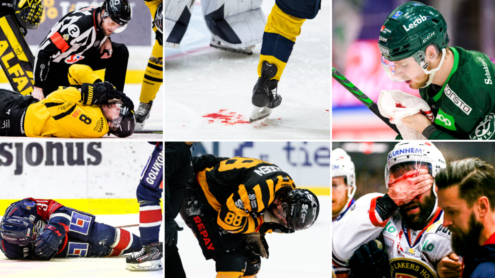 I princip varje vecka är det någon form av ansiktsskador inom svensk ishockey. Något som skulle undvikas om det vore krav på galler eller heltäckande visir för ansiktet - även för män.