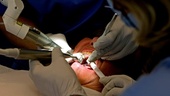 Onanerade i tandläkarstolen - döms för sexuellt ofredande