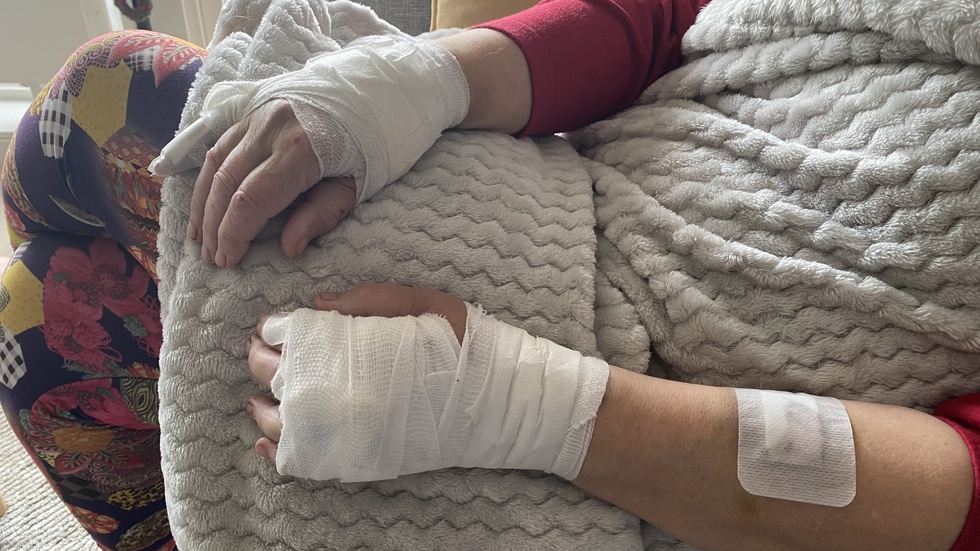 Nisses matte Christina fick flera skador på händer och armar efter att ha blivit biten när hon försökte skydda sin hund.