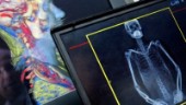 Regional satsning på medicinsk forskning