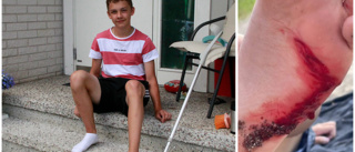 Matthias blev biten på badplatsen – av en gädda: "Jag trodde jag trampat på en vass kedja"