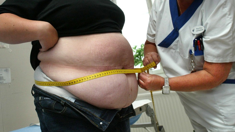 En ny studie visar att fetmaoperationer minskar risken för hjärtsvikt. (Arkivbild)