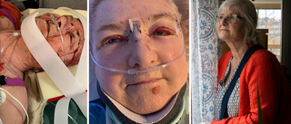 Lena blev förlamad i armen – polisanmäler neurokirurgen