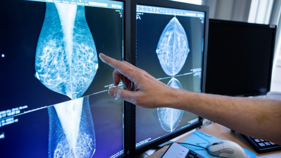 En läkare tittar på mammografibilder. Arkivbild.