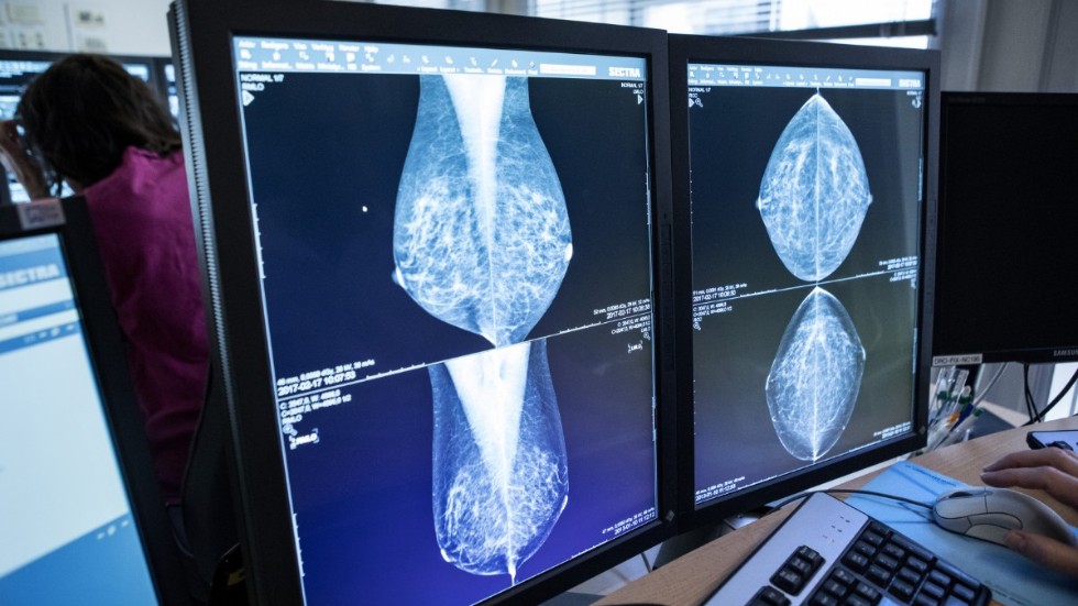 En läkare tittar på bröströntgenbilder.