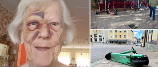Helena, 79, blåslagen efter vurpan över slängda elsparkcykeln: "Plötsligt låg jag framstupa på marken – jag fattade inget"