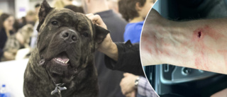 Brutala attacken: Skulle köpa pinnstolar – blev biten av hund