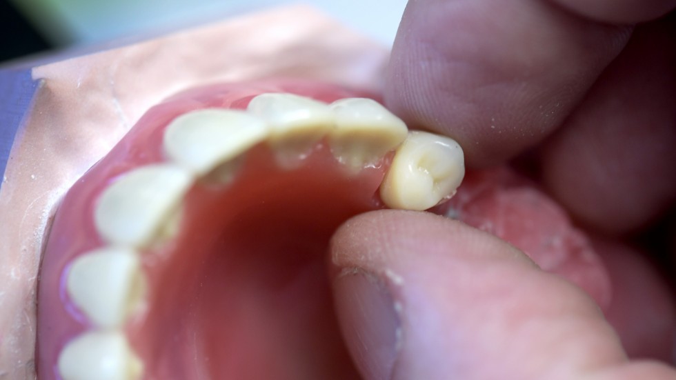 Så många som var tionde 65-plussare avstod från tandvård av kostnadsskäl år 2021, enligt Myndigheten för vårdanalys, skriver debattörerna.