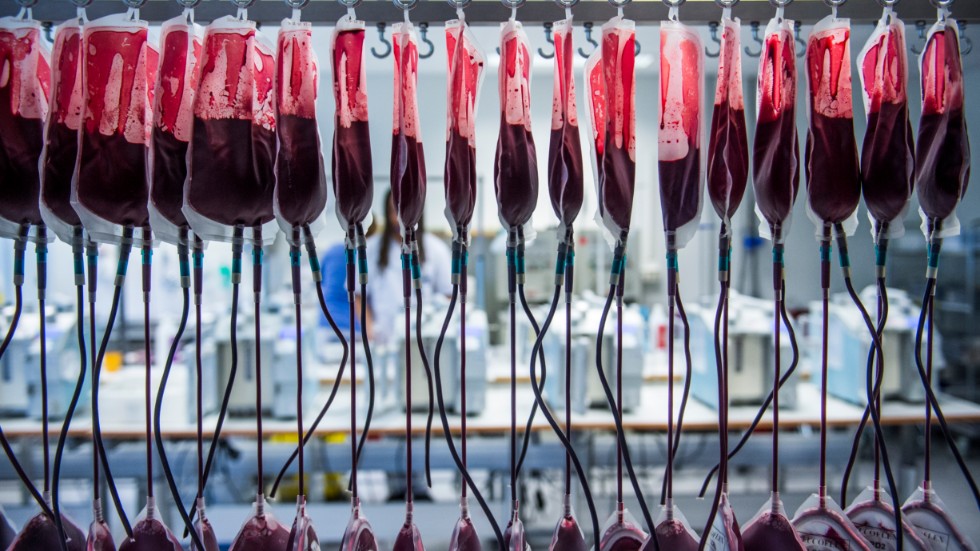 Ukraina har bett EU-länder att skänka 140 000 tomma blodpåsar.