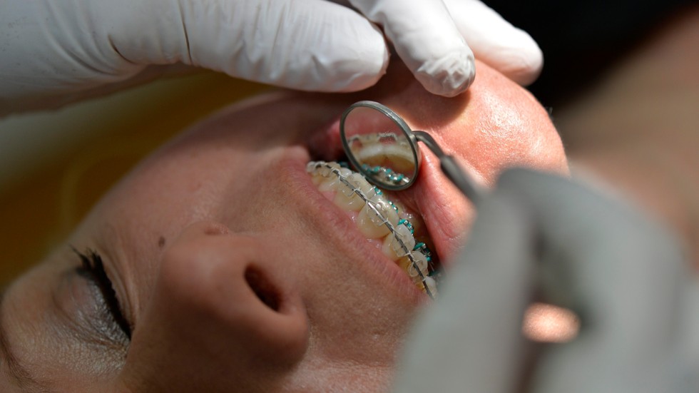 Debattörerna från Praktikertjänst varnar för att införa fler högkostnadsskydd i tandvården. Sådana reformer blir inget värda eftersom det råder står brist på tandläkare i Östergötland och i hela landet. 
