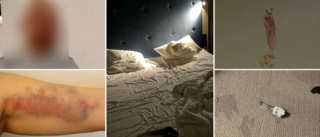 Kvinna flydde i morgonrock efter skräcknatt på hotell