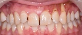 Tänderna är en del av kroppen 