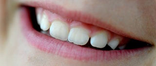 Tänderna är en del av kroppen