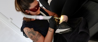 Hon lasrar bort tatueringar • Så fungerar behandlingen • Tatueringarna som Västervikarna ångrar mest