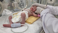 Gaza: Bebis räddad ur sin döda mammas livmoder