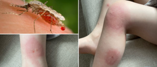 Sjuåring drabbades av allergireaktion efter skolutflykt