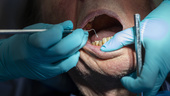 Gav säljare uppgifter – tappar tandvårdsstöd