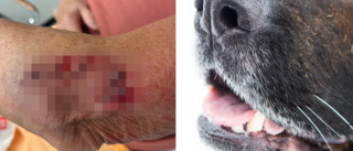 Kvinna i blodig attack – blev anfallen av okopplad hund