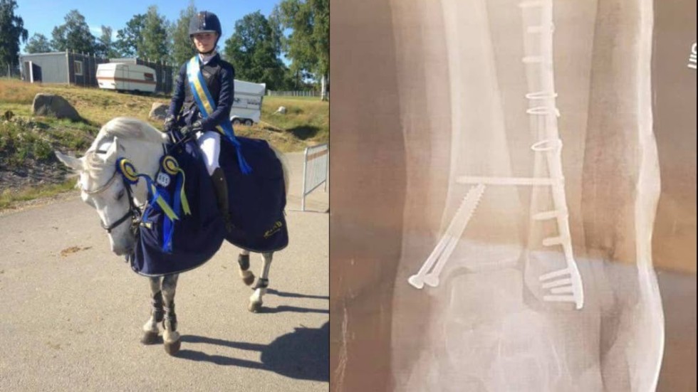 Saga Passmark från Vimmerby skadade sig allvarligt under en ridtur med hästen Storm.