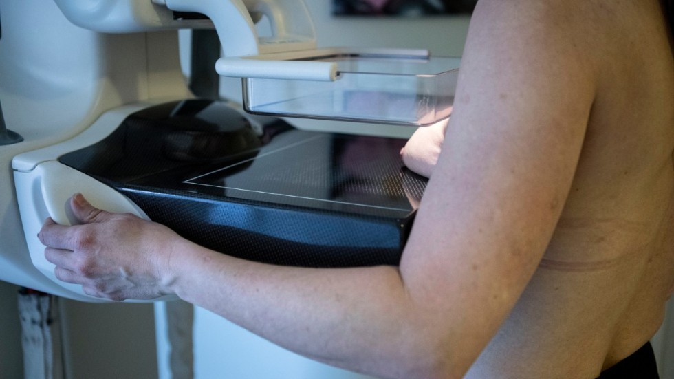 Mammografi ökar chansen att brösttumörer upptäcks i tidigt skede, men hur stor andel av kvinnorna som deltar skiljer sig stort i landet. Arkivbild.