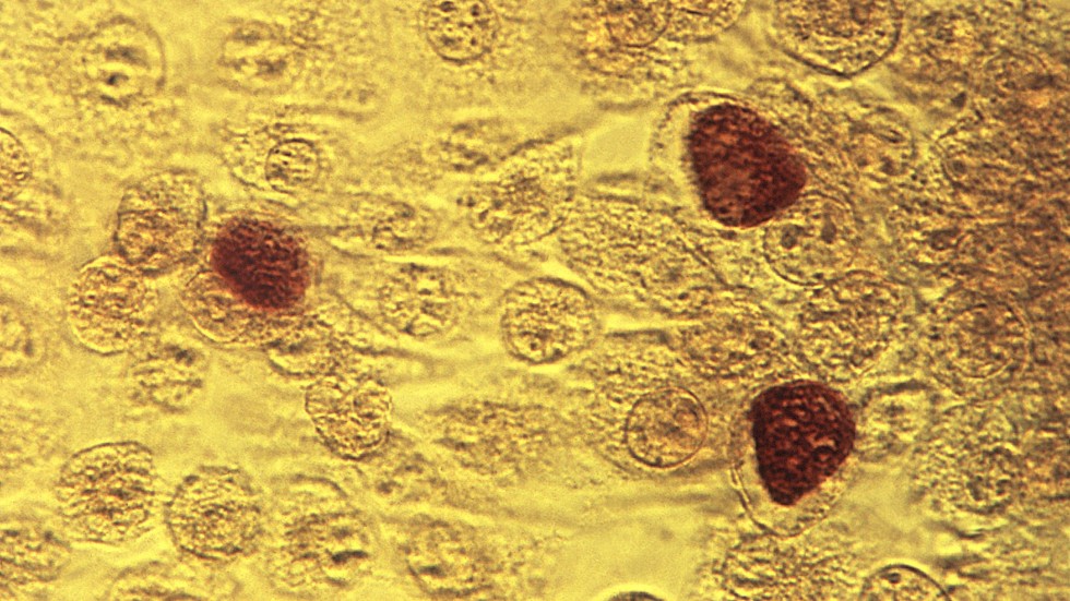 En klamydiabakterie uppförstorad 200 gånger, sedd genom ett mikroskop 1975. Bilden är tagen av den amerikanska folkhälsomyndigheten, Centers for disease control and prevention.