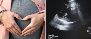 Nu erbjuds ett extra ultraljud till alla gravida    