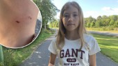 Råtta attackerade Jennifer, 14: "Den bet sig fast"