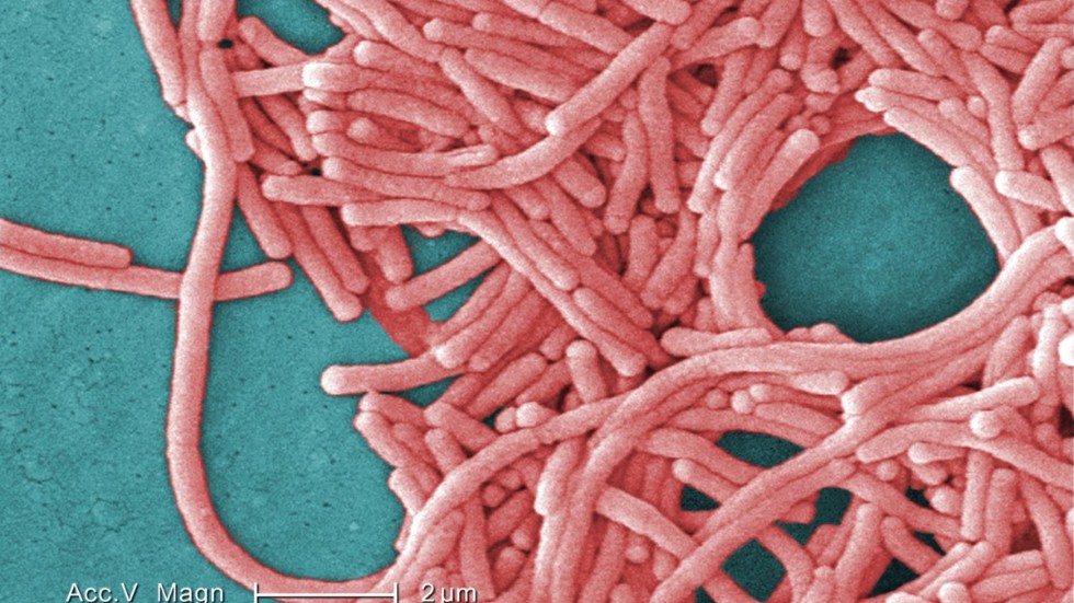 Legionellabakterier sedda genom att mikroskop. Arkivbild.