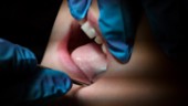 Fler sexåringar har hål i tänderna
