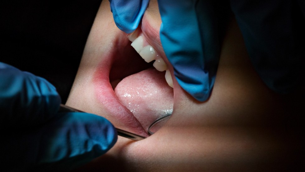 En ökning av tandlossningssjukdomen parodontit upptäcktes när data från över 1|000 15-åringar granskades. Arkivbild.
