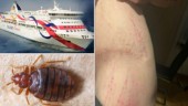 Fick vägglöss efter partyresan: ”Kliat sönder”
