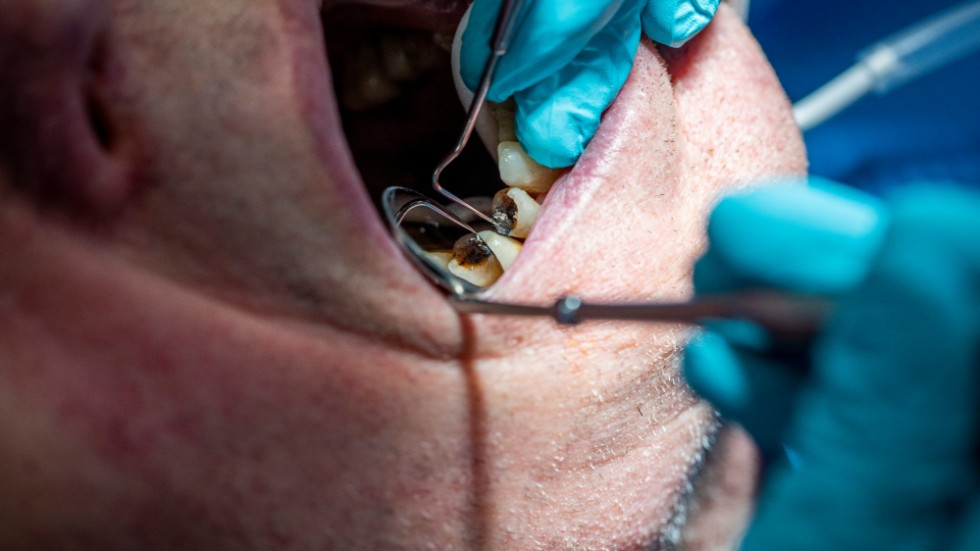 Enligt debattörerna stämmer inte informationen om att tandläkare inte får dra ut rotfyllda tänder, och de är kritiska till att tandläkare kan vilseledas då informationen är snårig.