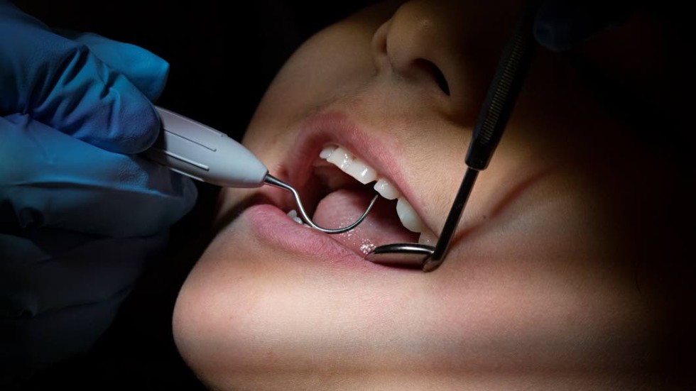Tandvårdsskadeförbundet är kritiskt till ökad användning av metaller i tandvården, såsom titan och kromkoboltlegeringar.