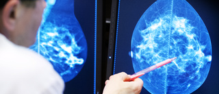 Mammografin släpar efter: "Några veckor att ta igen"