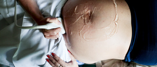 Gravid kvinna sövdes för skrapning – avbröts efter hjärtljud: ”Utsattes för psykiskt lidande” 
