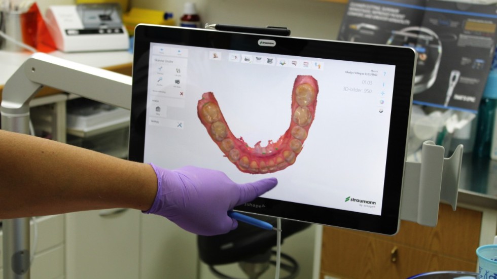 Direkt skapas en 3D-modell av tänderna som går att använda för att tillverka bland annat tandställningar och proteser.
